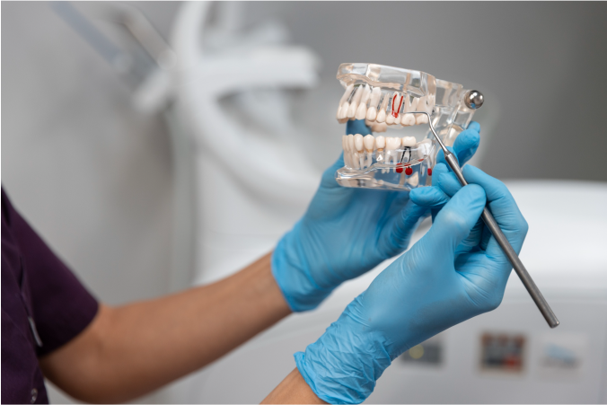 denture Implants